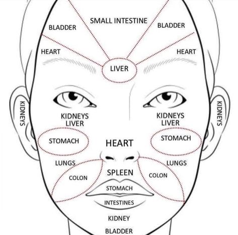 Acne Cream Diy, Face Acne Remedies, Chin Acne Causes, Acne Chart, Chinese Face Reading, Best Acne Scar Removal, Acne Scar Removal Cream, Acne Scaring, Face Mapping Acne