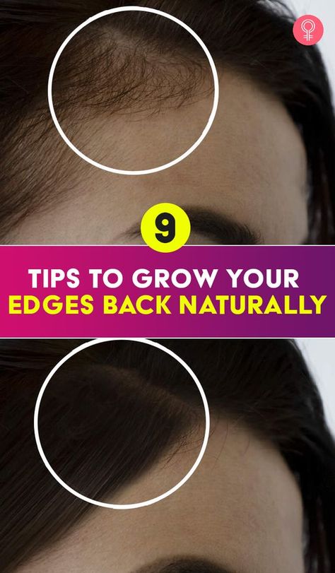 9 Tips To Grow Your Edges Back Naturally: How can you grow your edges back? This fragile hair needs extra care. If you continue over-handling them by wearing tight hairstyles like braids or weaves, they may break off and eventually cause hair loss. Grow Edges, Grow Hair Back, Hair Growth Methods, Thinning Edges, Stop Hair Breakage, Growing Healthy Hair, Hair Growing Tips, Edges Hair, New Hair Growth