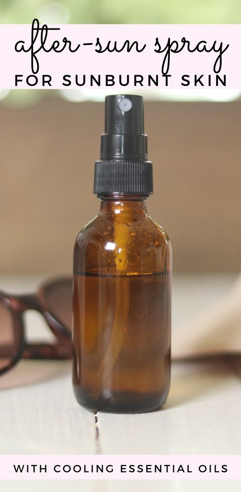 Diy After Sun Spray, Sunburn Essential Oils, Doterra Sunburn Relief, After Sun Spray Essential Oils, Doterra Sunburn, Sunburn Relief Essential Oils, Natural Sunburn Remedy, Essential Oil For Sunburn, Homemade Salve