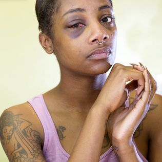 Seattle cop who punched handcuffed woman won’t face federal prosecution Eye Socket, Minds Eye, Black Eyes, African American Women, Eye Black, Police Officer, Black Lives Matter, Woman Face, The Face