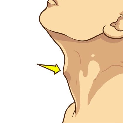 Adam's Apple (Gogó) Adam Apple, Body Works, Pikachu, Disney Princess, Disney Characters, Fictional Characters, Art