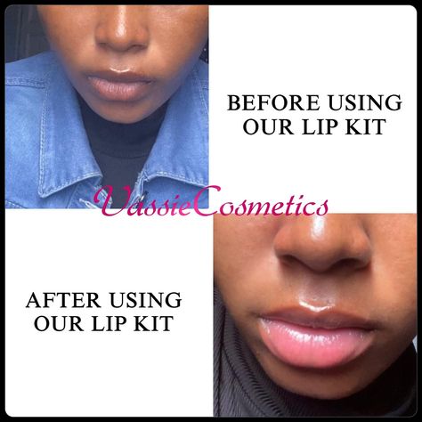 Our SPECIALIZED LIP CARE KITS are carefully designed to help get rid of Dark , Dry and Chapped Lips 👄 SWIPE TO SEE SOME OF OUR CLIENTS REVIEWS & TRANSFORMATION➡️➡️➡️ How To Use: 👄FLUFFY LIP SCRUB: The first step to achieving a healthy lips is regular exfoliation. Helps to remove dried skin cells on the lips making it soft,smooth and supple. Helps with easier penetration of the other lip care products. Use 2-3x weekly 👄LIP THERAPY BALM: Our Lip Therapy Balm helps treat dry/chapped lips an... On Call Whatsapp, Lips Balm, Pink Lip Balm, Lip Care Products, Lip Care Tips, Lip Masks, Lip Therapy, Dry Flaky Skin, Healthy Lips