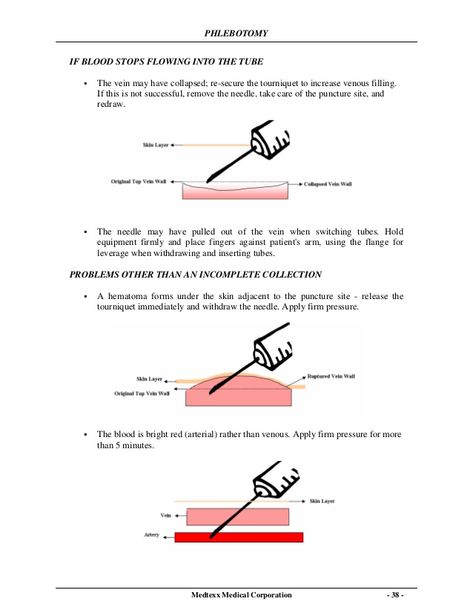 Berlin, Venipuncture Tips Phlebotomy, Phlebotomy Tips Training, Phlebotomy Outfits, Teaching Phlebotomy, Phlebotomy Scrubs, Phlebotomy Tattoo, Phlebotomy Study Notes, Phlebotomy Aesthetic