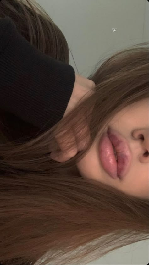 Lips Inspiration, Botox Lips, Lips Photo, Lip Filler, Lip Injections, Juicy Lips, Perfect Lips, Lip Fillers, Plastic Surgery