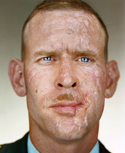 Martin Schoeller, Delta Green, Skin Grafting, 얼굴 드로잉, Face Reference, Military Heroes, Shooting Photo, American Heroes, Interesting Faces