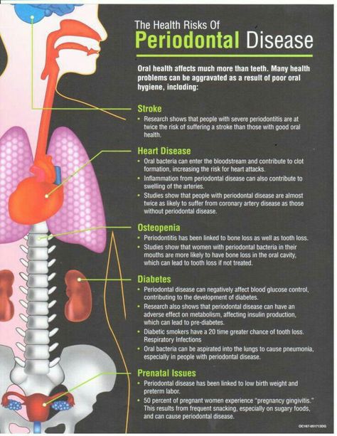 Periodontist Disease, Dental Education For Patients, Periodontal Disease Remedies, Dental Hygienist School, Hygiene School, Dental Assistant Study, Dental Hygiene Student, Dental Posts, Strong Teeth