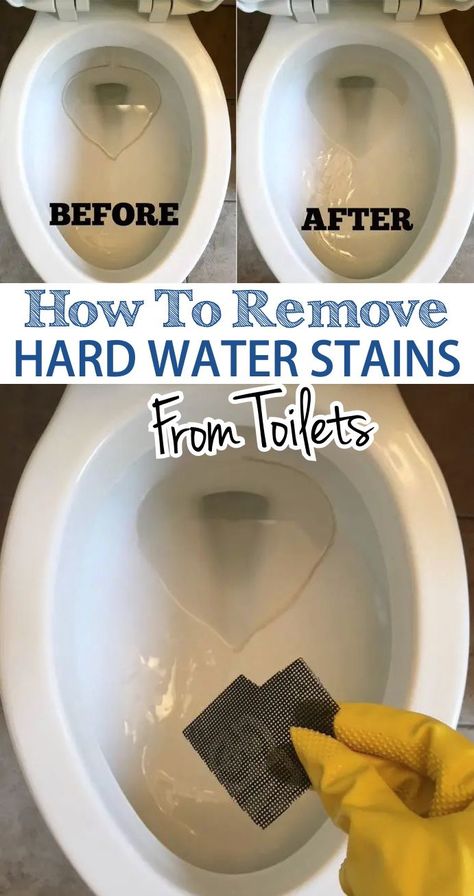 Ring In Toilet, Hard Water Ring In Toilet, Ring Around The Toilet, Toilet Stains Tough, Remove Toilet Bowl Ring, Remove Ring From Toilet Bowl, Calcium Build Up Remover Toilet, Homemade Toilet Bowl Cleaner Diy, Stubborn Toilet Bowl Stains