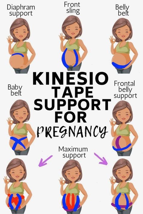 kinesiology tape support for pregnancy Taping Belly While Pregnant, Tape For Pregnant Belly, How To Tape Pregnant Belly, K Tape For Pregnancy, Pregnancy Belly Taping, Kinesio Tape Pregnancy, K Tape Pregnancy, Pregnancy Tape Belly, Taping Pregnant Belly