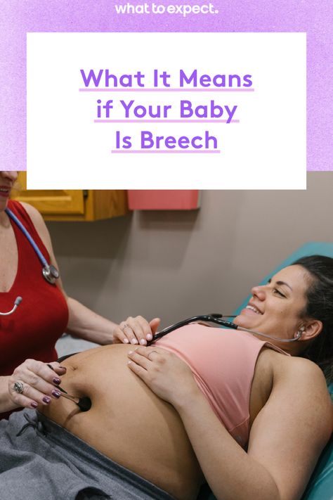 Did your practitioner say your baby is in a breech position? Here's why some babies end up in the head-up position, and what you can do if your baby is breech. Baby In Womb, Breech Babies, 35 Weeks Pregnant, Baby Weeks, First Time Pregnancy, Fetal Position, Pregnancy Months, First Pregnancy, Nine Months