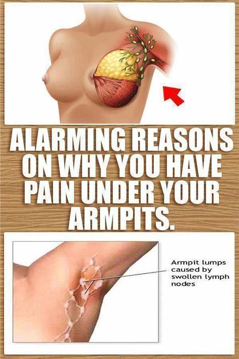 Do You've A Lump On your Neck, Back, Or Behind Your Ear? This can be What It Means #Gemsandminerals #LumpUnderSkinOnHead #PinkLumpOnSkin #SoftLumpOnSkin #RedBumpsOnSkin #LumpOnRightSideOfNeck #LumpUnderSkinOnArm #LumpOnHead Lump In Armpit, Armpit Lump, Small Bumps On Face, Lump Behind Ear, Skin Bumps, Lymph Nodes, 5 Months, Herbal Remedies, How To Use