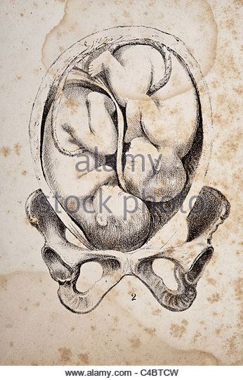 Twins In The Womb, Organ Anatomy, Handmaids Tale, Birth Art, Fetal Position, Pregnancy Art, Belly Painting, Mother Art, Figure Sketching