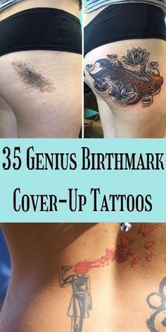 Birthmark Tattoo, Port Wine Stain, Women Eyes, Chicano Tattoos Sleeve, Funny Tattoo, Theme Tattoo, Gorgeous Tattoos, Forearm Tattoo Women, Omg Funny