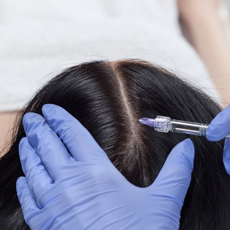 Hair fall and hair thinning are the two most common hair conditions faced by patients. If you are seeking for hair regrowth, then you would have come across Platelet Rich Fibrin (PRF) and Platelet Rich Plasma (PRP). But how do they help in stimulating hair growth? How to differentiate between the two? Read this blog to find out more. Platelet Rich Plasma Therapy, Prp Hair, Androgenetic Alopecia, Lifting Facial, Platelet Rich Plasma, Hair Thinning, Scalp Conditions, Regrow Hair, Aesthetic Clinic