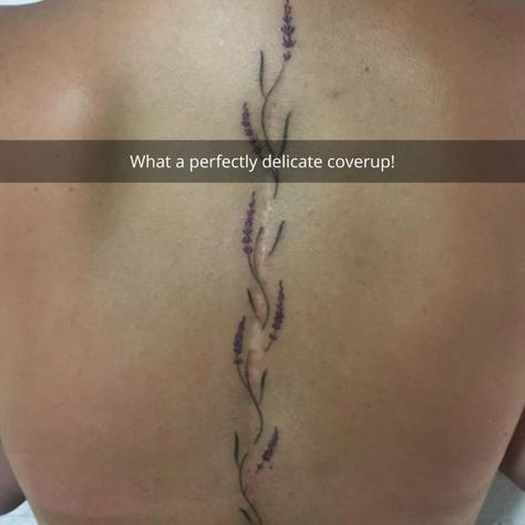 Tattoo Over Back Scar, Line Scar Tattoo Cover Up, Cool Scar Tattoos, Flower Tattoo Over Scar, Scar Hiding Tattoo, Tattoo Around Scar, Tattoos For Scars Cover Up, Back Scar Tattoo, Small Scar Tattoo