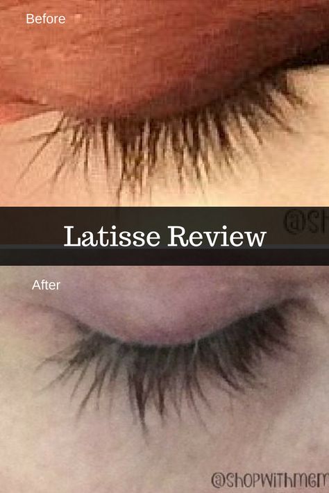 Latisse Before And After Eyelashes, Latisse Before And After, Latisse Eyelashes, Funny Birthday Gift Ideas, Marble Mug, Personal Pictures, Bible Verses For Women, Bible Women, Gifts For Aunt