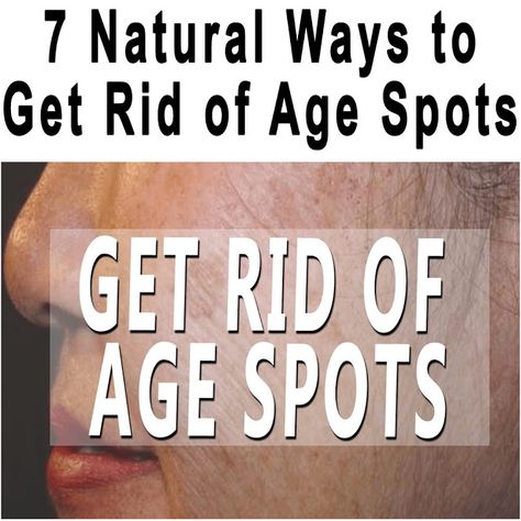 How To Get Rid Of Brown Spots, How To Get Rid Of Age Spots On Skin, Age Spots On Face How To Get Rid Of, Diy Age Spot Remover, How To Get Rid Of Age Spots On Hands, Get Rid Of Age Spots On Face, Remove Age Spots On Hands, Remove Age Spots On Face, Natural Age Spot Remover