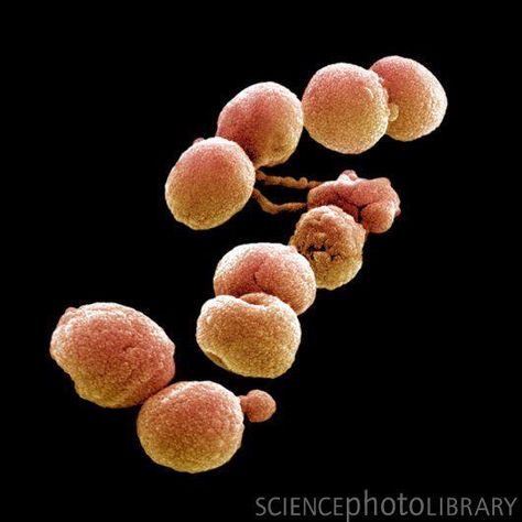 Streptococcus pneumoniae, coloured scanning electron micrograph Scanning Electron Microscope Images, Upper Respiratory Tract, Streptococcus Pneumoniae, Microscope Images, Electron Microscope Images, Scanning Electron Microscope, Under Microscope, Scanning Electron Micrograph, Microscopic Photography