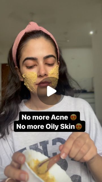 Shatakshi Maithani on Instagram: "Here is the best Face Mask for Oily & Acne prone Skin. 

The mask offer several benefits:
1. Skin Brightening
2. Anti-inflammatory and Antibacterial Properties
3. Exfoliation and Cleansing
4. Moisturizing and Hydrating
5. Anti-Aging

Using this mask once or twice a week can help improve the overall health and appearance of your skin.

#skin #skincaretips #skincare #skinhealth #skinfade #skingoals #skintreatment #skintips #acne #acnetreatment #acneproblems #skinlove #skinrejuvenation #skinlove #skincareroutine #clearskin #oilyskin #trendingreels #trending #trend #trendy #trendalert #trendingnow #trendingsongs #trends #trendsetter #trendylook #selflove #pamperyourself #happy" Face Mask For Oily Skin, Face Mask For Acne, Oily Acne Prone Skin, Mask For Oily Skin, Best Face Mask, Best Face, Skin Tips, The Mask, Skin Rejuvenation