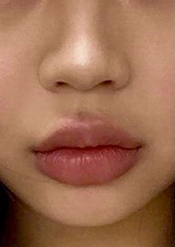 Heavy Lower Lip Shape, Desire Face Ideas, Round Lips Shape, Round Cupids Bow Lips Aesthetic, Small Round Lips, Upturned Lips Corners, Narrow Lower Face, Small Plump Lips, Bigger Bottom Lip