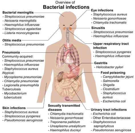 Difference Between Upper Respiratory Infection and Bronchitis Upper Respiratory Infection, Pharmacy School, Respiratory Infection, Nursing School Notes, Medical Coding, Nursing Tips, Medical Laboratory, Bacterial Infection, Nursing Study