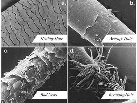 Hair Under Microscope, Apple Cider Vinegar Hair Rinse, Vinegar Hair Rinse, Apple Cider Vinegar For Hair, Hair Science, Hair Facts, Hair Structure, Breaking Hair, How To Grow Natural Hair