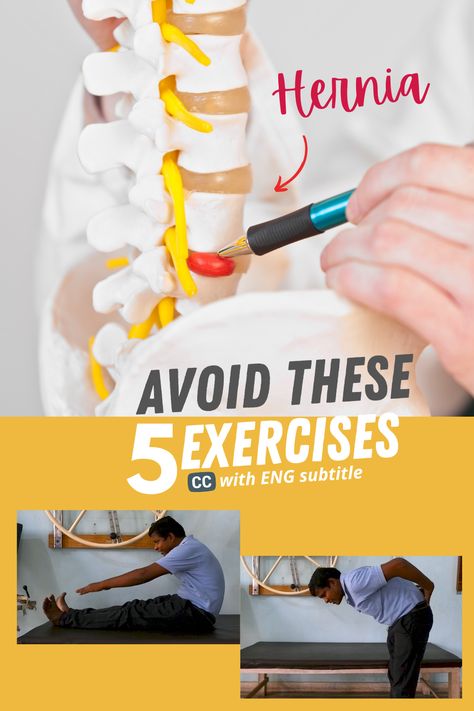 Exercises To Help Herniated Discs, Herniated Disk In Lower Back Relief, Bulging Disc Lower Back, Herniated Disk In Lower Back, Bulging Disc Exercises, Disc Exercises, Nerve Exercises, Disc Herniation, Types Of Cardio