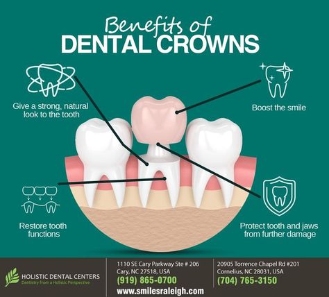 If you have damaged or missing teeth, we know how it would affect your confidence. That’s why we help you restore your smile with natural-looking dental crowns. Dial (919) 865-0700 / (704) 765-3150 for advice. #DentalCrowns #cornelius #NC #holisticdentalcenters Sedation Dentistry, Dentist Visit, In Smile, Restorative Dentistry, Dental Center, Dental Crowns, Family Dental, Dental Art, Family Dentistry