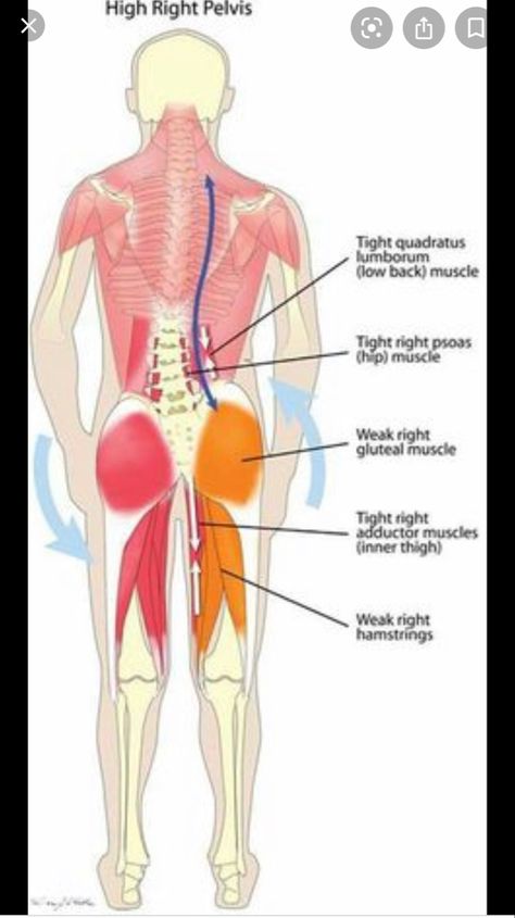 Misaligned Pelvis, Punkty Spustowe, Muscle Imbalance, Spine Health, Muscle Anatomy, Simple Health, Hip Muscles, Back Pain Exercises, Body Anatomy