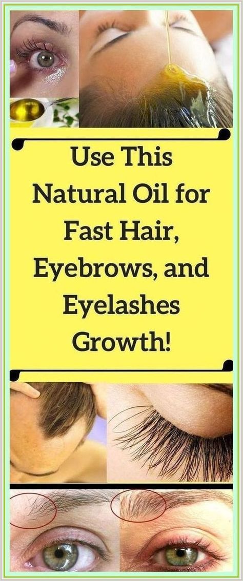 Put This Oil And You’ll See How Fast Will Grow Your Hair, Eyelashes and Eyebrows! Eyelashes And Eyebrows, Walking For Health, What Is Health, Healthy Plan, Health Questions, Luscious Hair, Healthy Advice, Simple Health, Natural Parenting