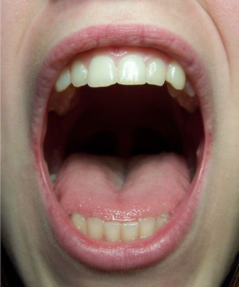 Woman With Mouth Open Reference, Wide Open Mouth Reference, Mouth Biting Reference, Bared Teeth Drawing Reference, Mouth Close Up, Open Mouth Reference Photo, Mouth Open Pose, Mouth Reference Photo, Open Mouth Drawing Reference