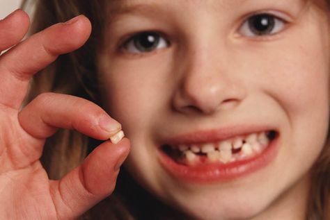 Teeth Falling Out Dream, Milk Teeth, Homeschooling Resources, Teeth Straightening, Perfect Teeth, White Smile, Spanish Classroom, Perfect Smile, Baby Milk