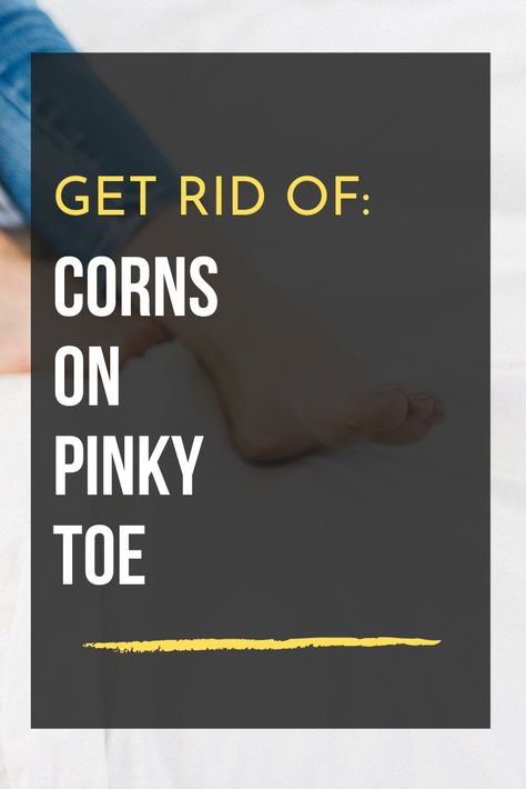 Remove Corns On Feet Remedies, Get Rid Of Corns On Feet Fast, Foot Corn Removal Remedies, How To Get Rid Of Corns On Toes, Corn Removal On Toes, Get Rid Of Corns, Feet Remedies, Corn Removal, Throat Remedies