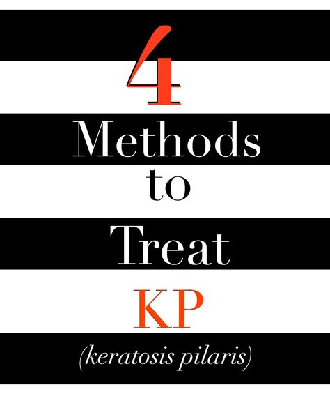 4 Methods to Treat KP--Over the Counter Treatments for Keratosis Pilaris Keratosis Pilaris, Skin Conditions, Keratin, Home Remedies, Healthy Hair, Healthy Skin, Health And Beauty, Beauty Hacks, Hair Hair