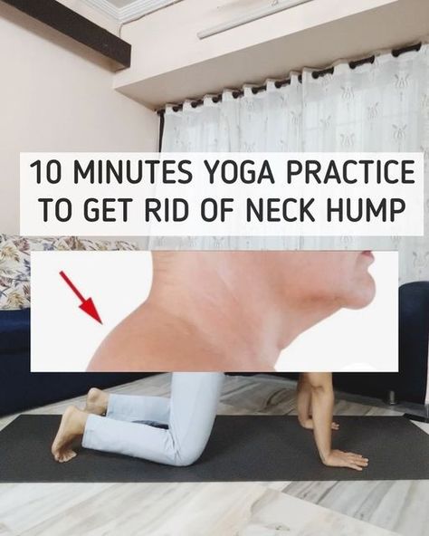 Anjaly Warrier | Expert in Yoga for Weight Loss on Instagram: "🌿 Say Goodbye to Neck Hump with Yoga! 🌿

Hey there! 🌈 Have you lately noticed a hump forming at the base of your neck? This common issue, often called a neck hump or dowager’s hump, arises from poor posture—like slouching over our gadgets and desks. 🖥️📱 This posture can cause the muscles and ligaments in your neck and shoulders to strain and adapt poorly, contributing to that noticeable hump. 😞

Yoga can help reverse and prevent this! 🚀 Through specific yoga poses, you can strengthen and stretch the neck and upper back muscles, promoting better posture and reducing tension. 🧘‍♀️🧘‍♂️

Ready to straighten up and enhance your posture? 🌟 Dive into our yoga routine tailored to combat neck hump. This sequence is designed to Workout Morning, Neck Hump, Upper Back Muscles, Health Hacks, Better Posture, Poor Posture, Back Muscles, Yoga Routine, Hey There