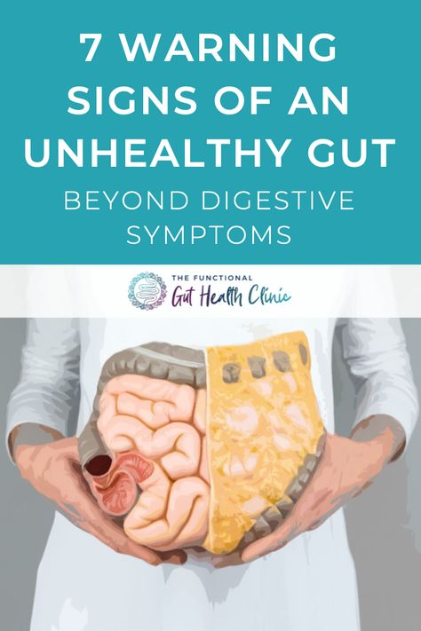 Heal Digestive System, Diet To Improve Gut Health, Poor Gut Health Symptoms, Gut Healing Journey, Signs Of Poor Gut Health, Irritable Bowel Disease Symptoms, Gut Recipes, Irritable Bowel Disease, Gut Problems