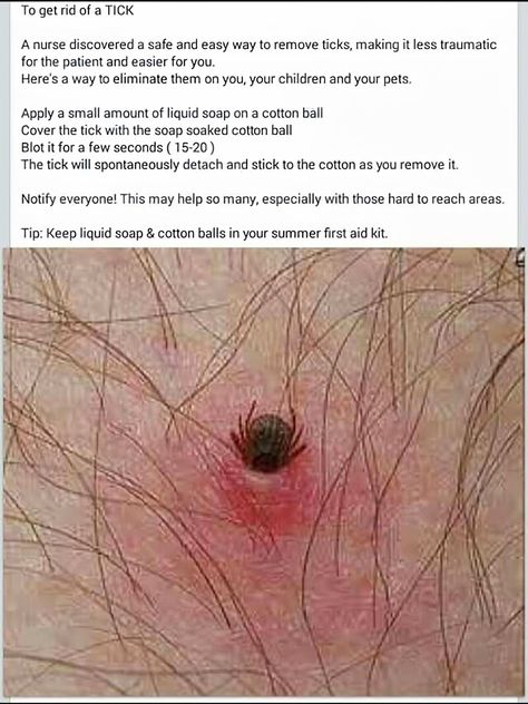 Lou Dog, Tick Removal, Best Hacks, Survival Life Hacks, Everyday Hacks, Survival Life, Toning Workouts, Emergency Prepping, Simple Life Hacks