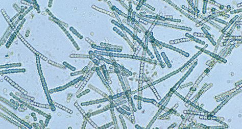 Biological Science, Microscopic Organisms, Life On The Edge, Blue Green Algae, Rocks And Fossils, Science Articles, Green Algae, Scientific Discovery, Cell Wall