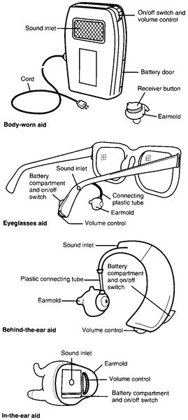 Eyeglass model hearing aid | definition of eyeglass model hearing aid by Medical dictionary Medical Dictionary, Medical Terms, Hearing Aids, Medical, Inspirational Quotes, Quotes