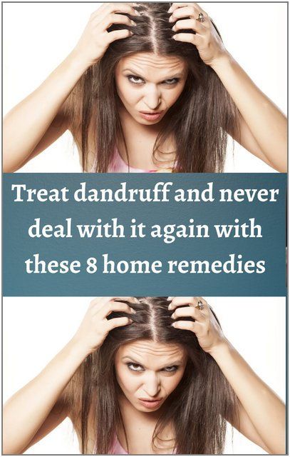 How To Reduce Dandruff, Treat Dandruff, Reduce Dandruff, Dream Cars Jeep, Itchy Scalp, Fungal Infection, Tired Eyes, Deal With It, Eye Strain