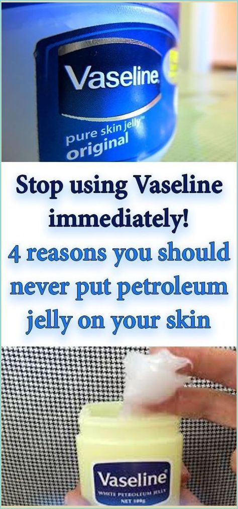 Stop Using Vaseline Immediately! Petroleum Jelly, School Communication, Vaseline, Health Remedies, Apple Cider, Home Remedies, Natural Remedies, Baking Soda, Your Skin