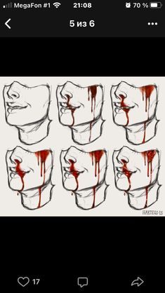 Injury Drawing Reference, Poses Art Reference, To Draw Ideas, Poses Art, 2022 Art, Blood Art, Body Reference Drawing, Draw Ideas, Drawing Expressions