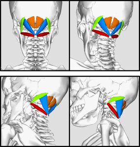 Suboccipital Muscles, Cervicogenic Headache, Daily Headaches, Relieve Neck Pain, Neck Problems, Chronic Migraines, Strengthening Exercises, Migraine Headaches, Shoulder Pain