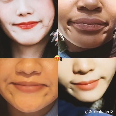 Type Of Dimples, Mouth Corner Dimples, Deep Dimples Aesthetic, Aesthetic Dimples, Types Of Dimples, One Dimple, Cute Dimples, Crazy Video, Back Dimples