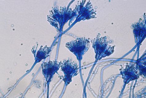 The Lactophenol Cotton Blue (LPCB) wet mount is most widely used method for the staining and observation of fungi. Principle LPCB is a stain used for makin Bacteria Cartoon, Flashcard Maker, Under Microscope, Microbiology Lab, Microscopic Photography, Birthday Cartoon, Cell Wall, Blue Stain, Things Under A Microscope