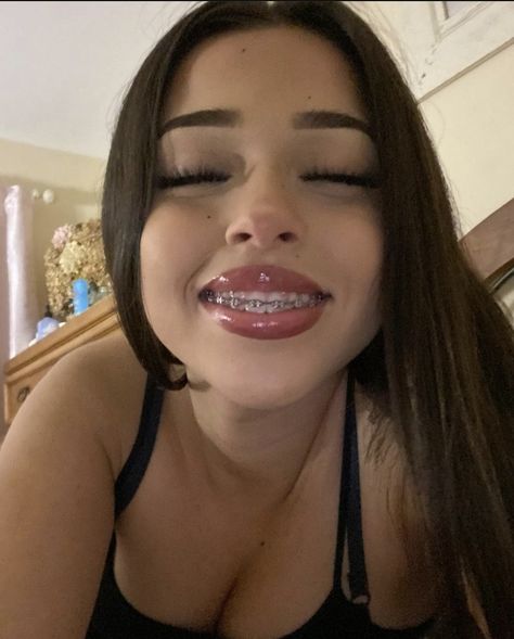 Lantinas Girl, Selfie Pretty Woman, Makeup With Braces, Pretty Girl Braces, Teeth Braces Aesthetic, Cute Braces Colors Aesthetic, Latina With Braces, Light Pink Braces, Pretty Latina Makeup