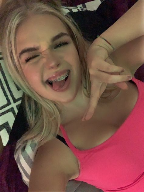 girl with braces aesthetic bracesgoals goals cute back to school Braces Aesthetic, Girl With Braces, Braces And Glasses, Black Braces, Cute Braces Colors, Pretty Teeth, Pretty Blonde Hair, Girl With Pigtails