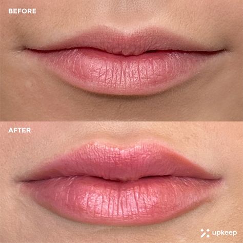 Glow up on demand with 1 full syringe of filler! Book vetted medical aesthetic treatments near you on the Upkeep app! Available on iOS & Google Play! # 1ml lip filler natural lip fillers lip filler inspo lip filler aesthetic lip injection shapes lip fillers before and after Natural Lip Fillers 1ml, Lip Filler Natural, Natural Lip Fillers, Lip Filler Before And After, Lip Filler Aesthetic, 1ml Lip Filler, Filler Aesthetic, Aesthetic Treatments, Small Lips