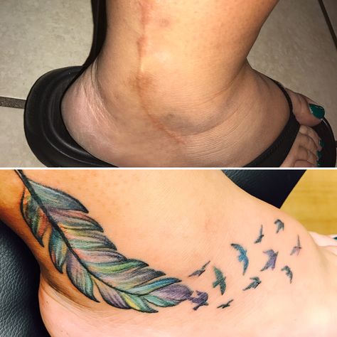 Scar cover up! Ankle Tattoo To Cover Scar, Ankle Scar Tattoo Ideas, Tattoo Ideas For Scar Cover Up, Surgical Scar Tattoo Cover Up, Ankle Scar Tattoo Cover Up, Ankle Scar Tattoo, Tattoo Ideas To Cover Scars, Tattoo Scar, Tattoo Over Scar