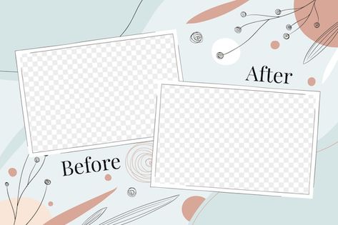 Before After Background, Before And After Background, Before And After Template, Ballet Theater, Background Template, Graphic Resources, Theater, Vector Free, How To Draw Hands