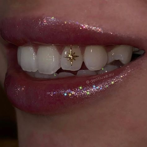 Pretty Teeth, Dental Jewelry, Gold Tooth, Grillz Teeth, Maquillage On Fleek, Diamond Teeth, Tooth Gems, Grills Teeth, Tooth Gem